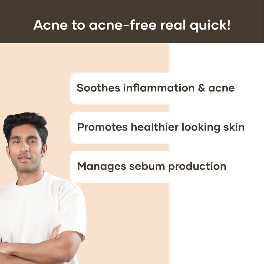 Best Anti Acne Gel for Men | Pimple Removal for Clear Skin | Niacinamide Gel | Salicylic acid Gel