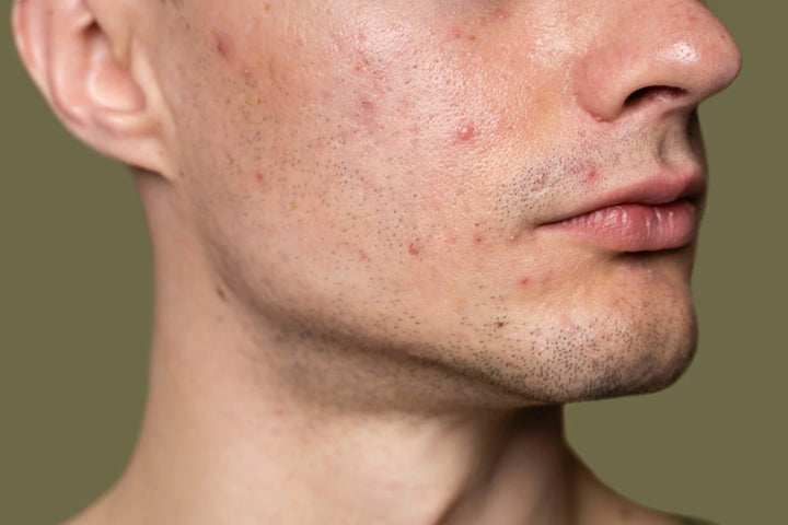 benefits of using toner | What are the benefits of using a face toner?