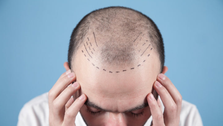 Hairline