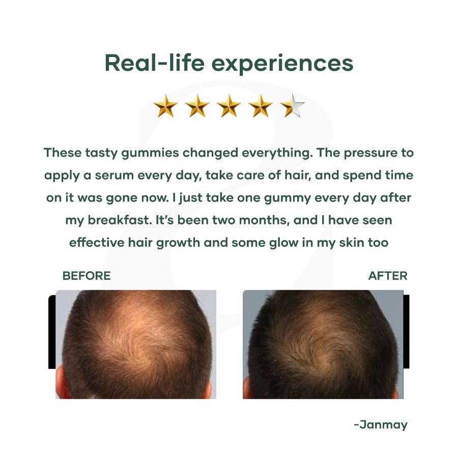 Biotin Gummies for Hair, Skin, Nails (30 N)